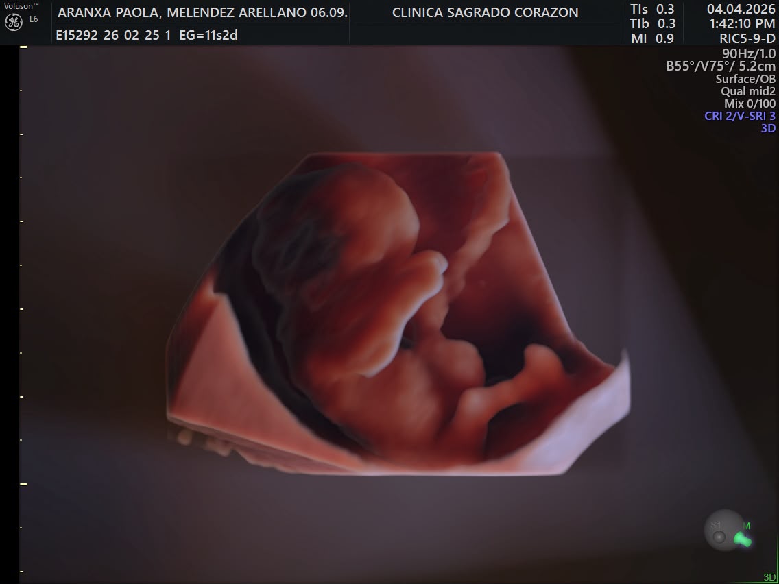Recuerdo de Baby Paulo 1
