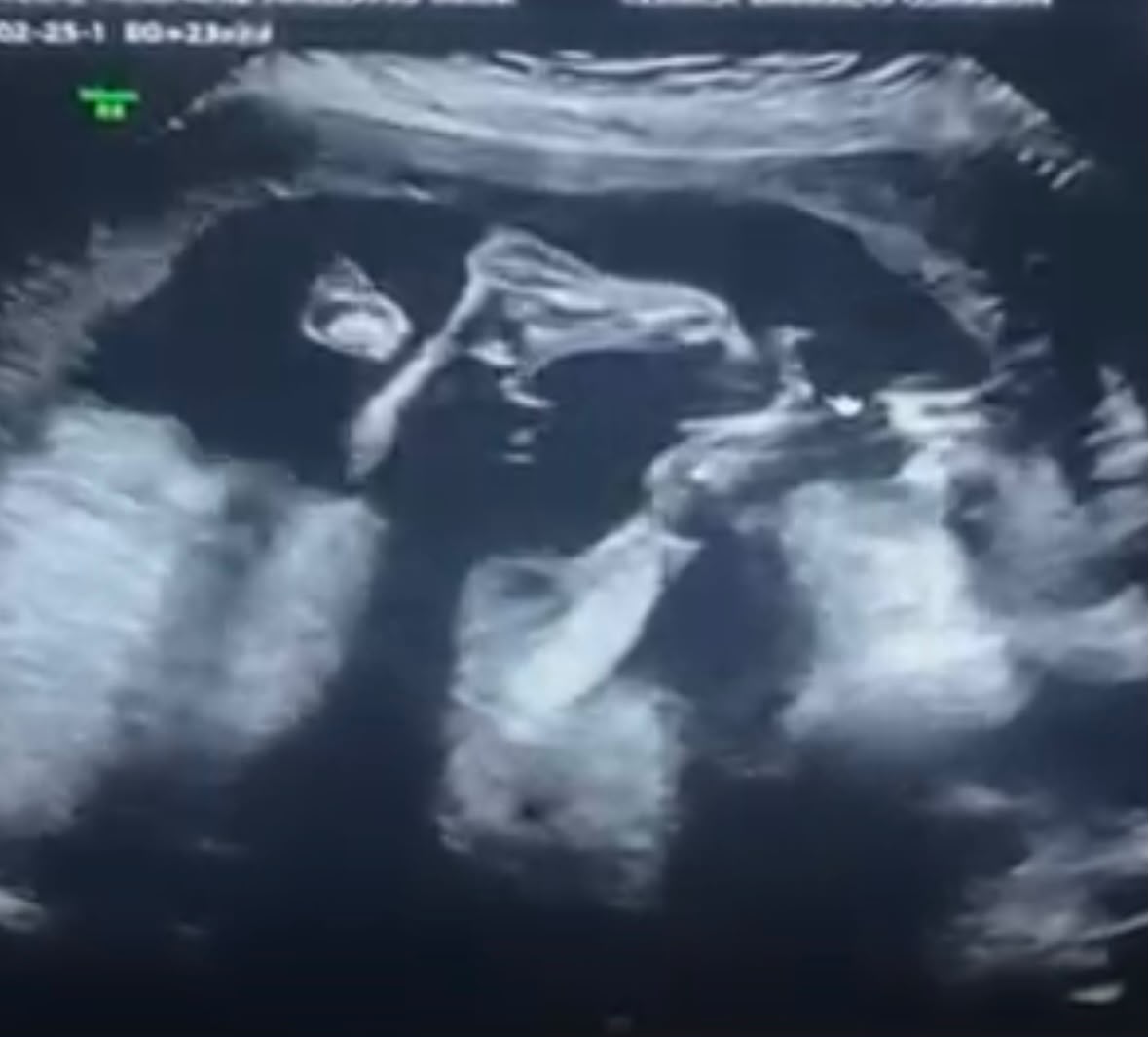 Recuerdo de Baby Paulo 4
